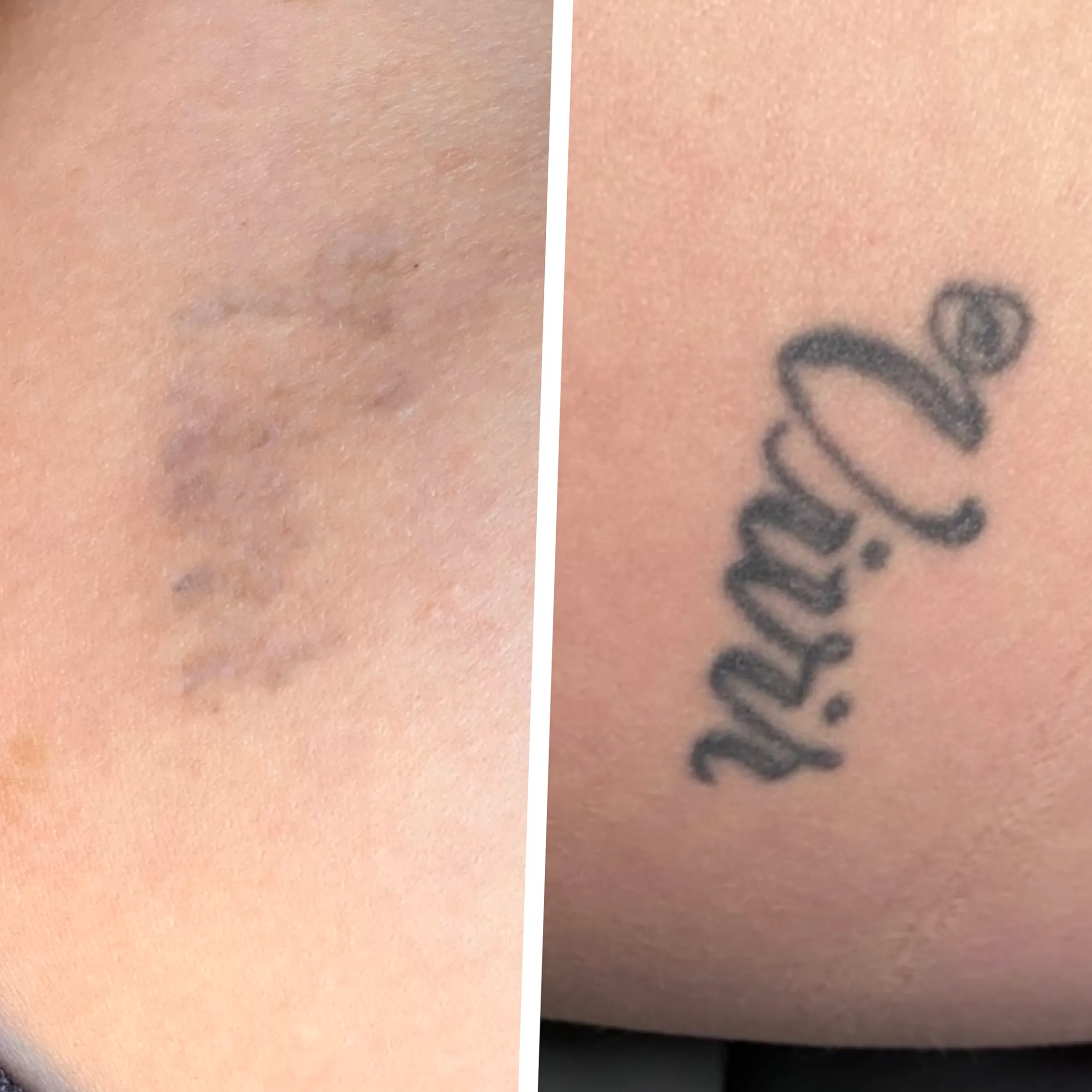 tattoo fading prevention tips