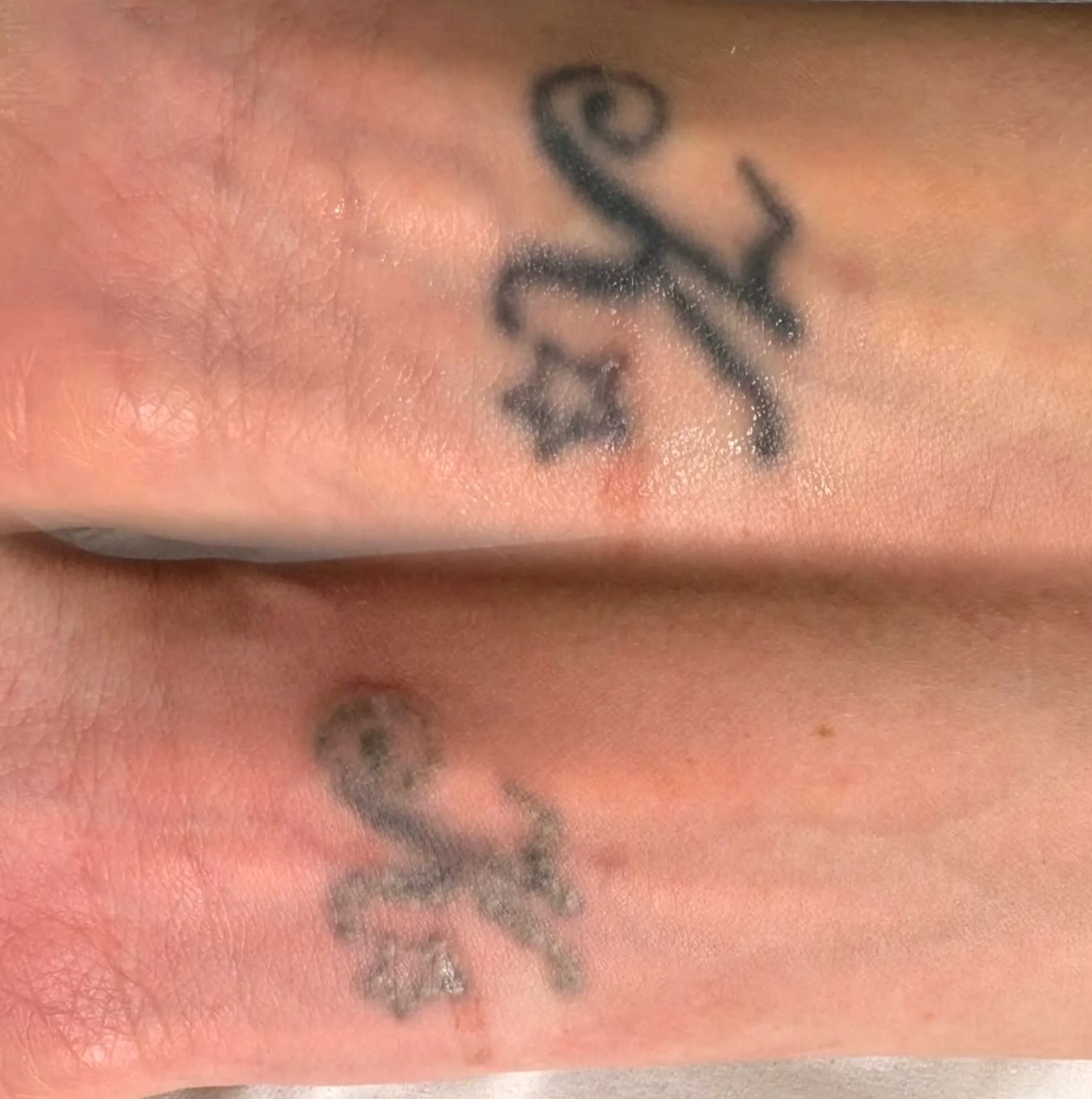 how to remove temporary tattoos