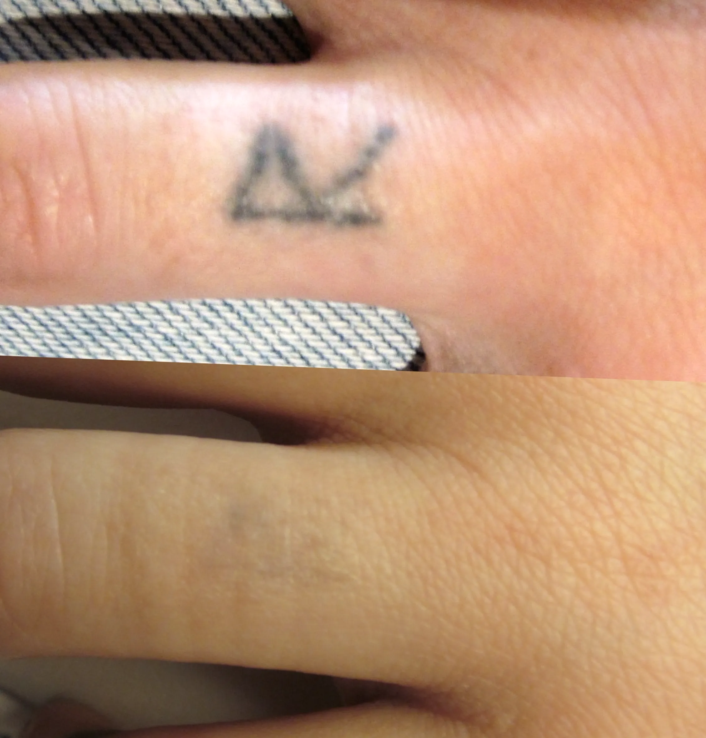 tattoo aftercare Melbourne