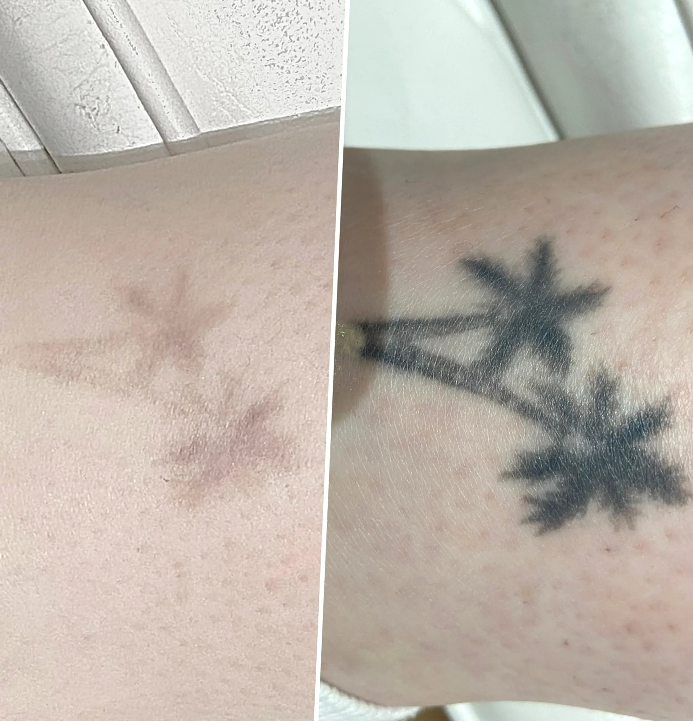 does hand sanitiser fade tattoos