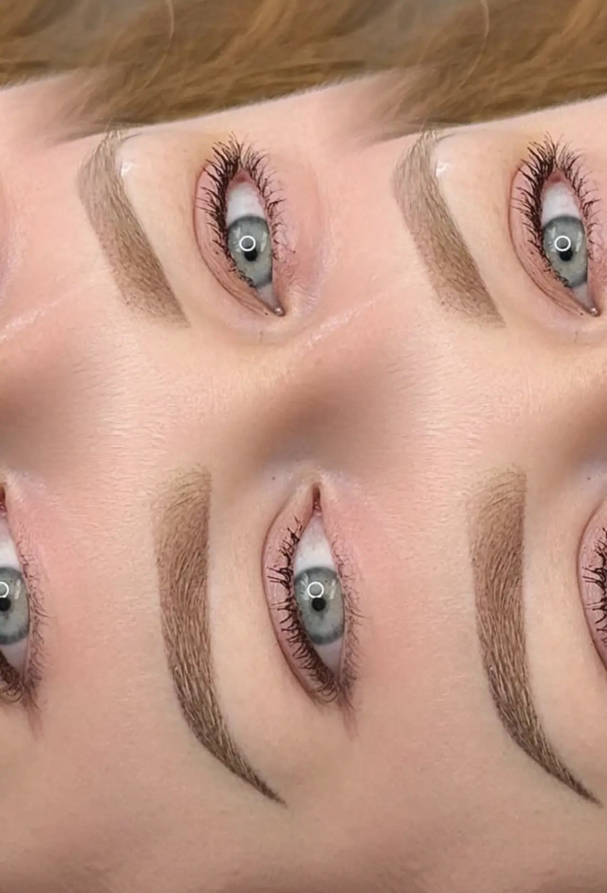 eyebrow laser tattoo removal